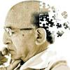 undefined Alzheimer: Definição, Fases E Sintomas