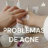 undefined PROBLEMAS DE ACNE